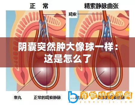 陰囊突然腫大像球一樣：這是怎么了